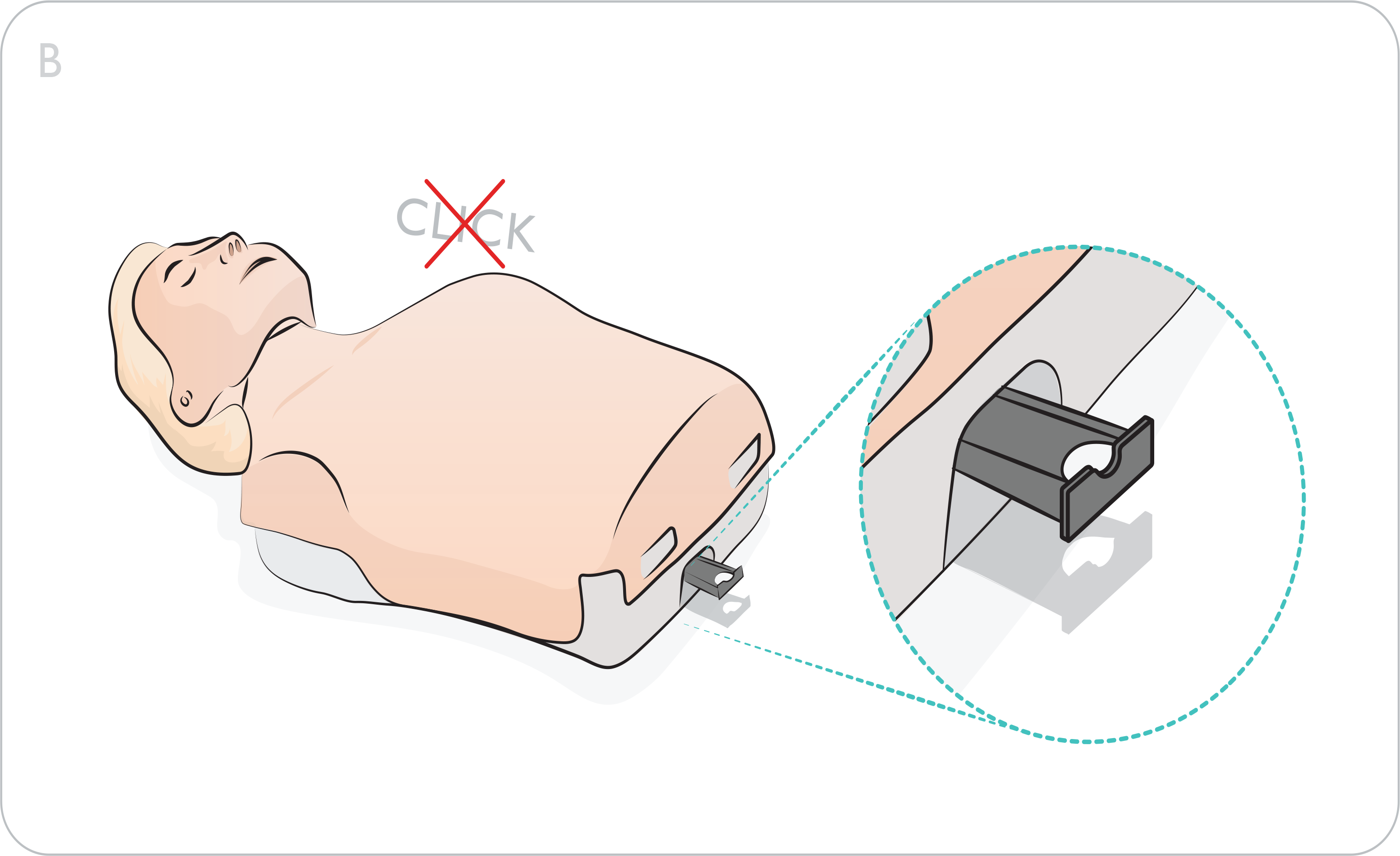 Fig 3.B